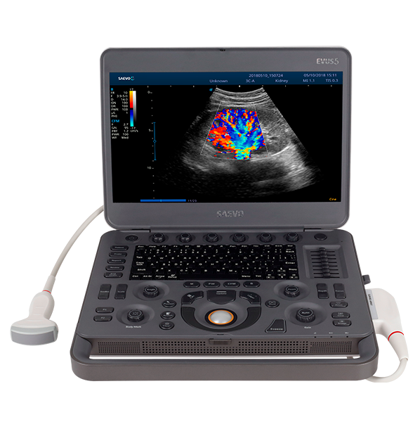 Ultrasound – Evus 5