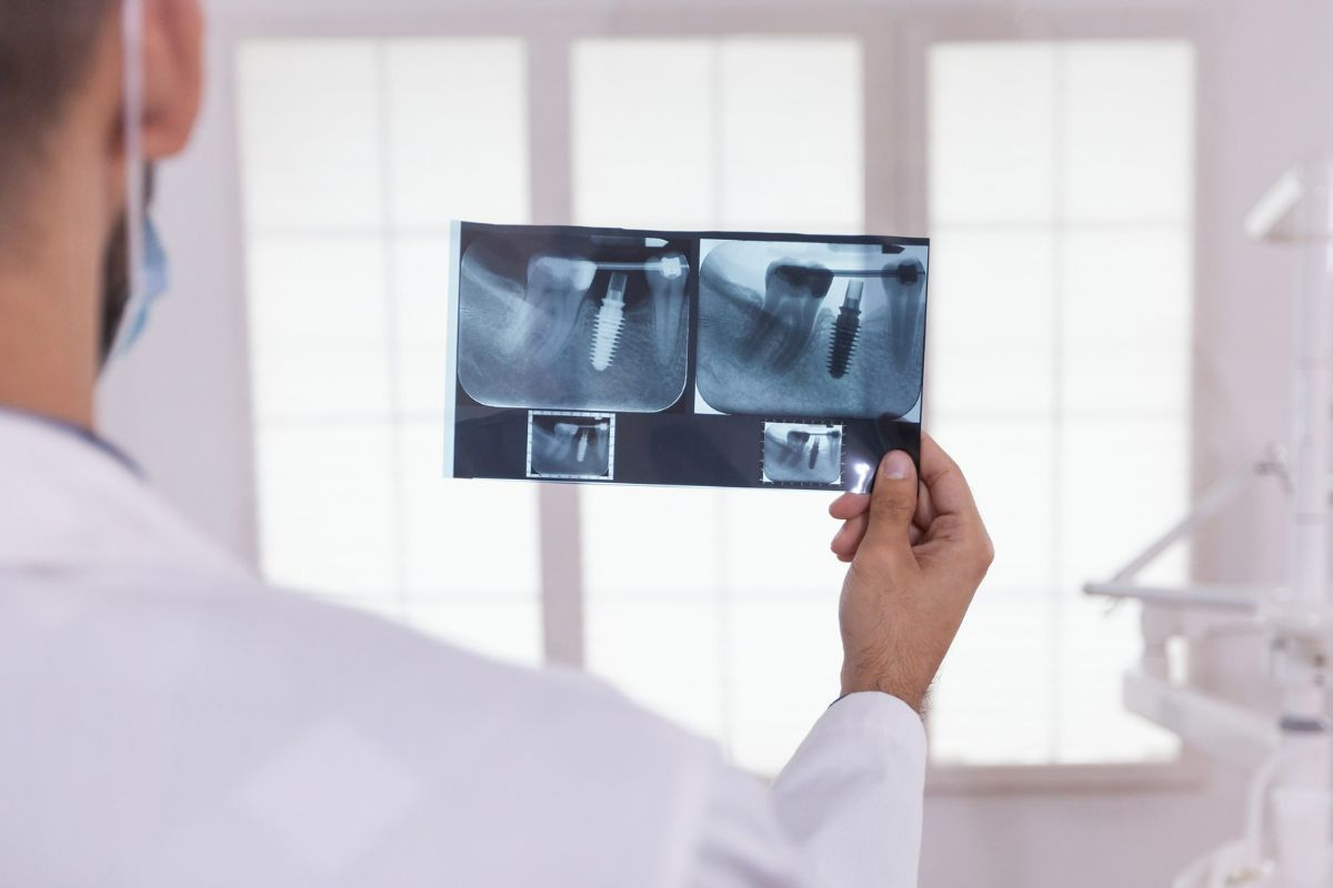 Radiografia periapical de arcos completos: veja quando é solicitado o exame