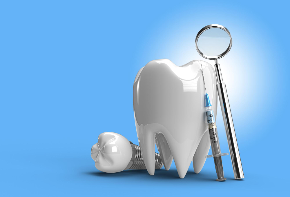 Implante dentário: o que é e quem pode realizá-lo