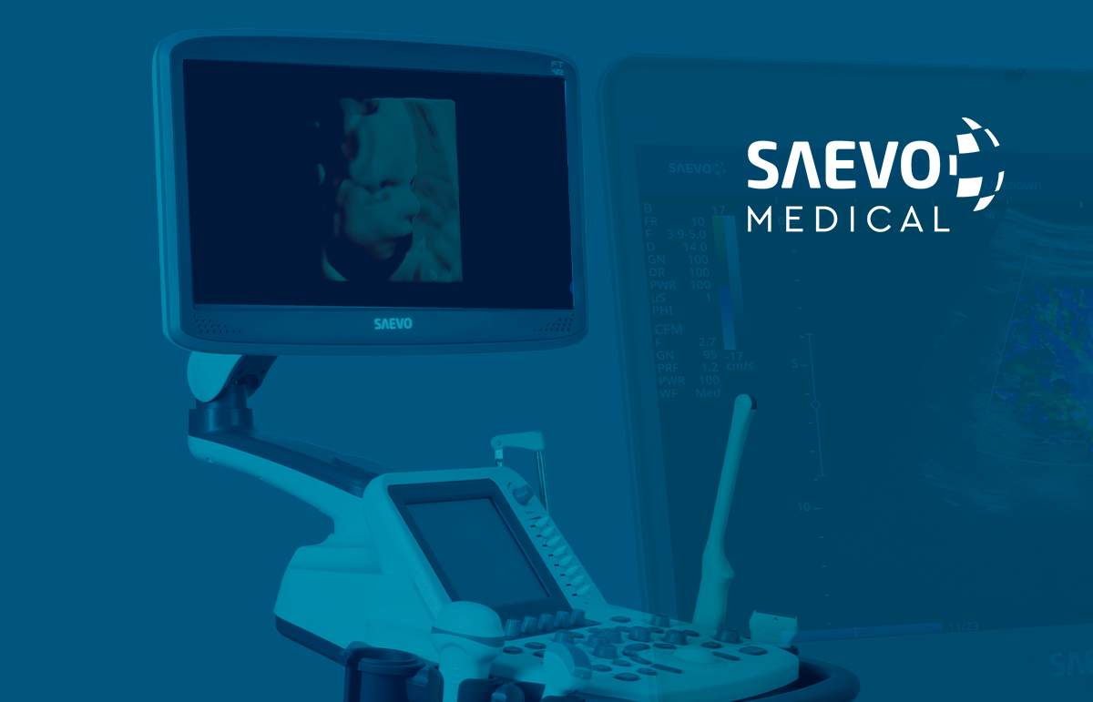 Linha de Ultrassons da Saevo Medical: Tecnologia avançada para diagnósticos médicos